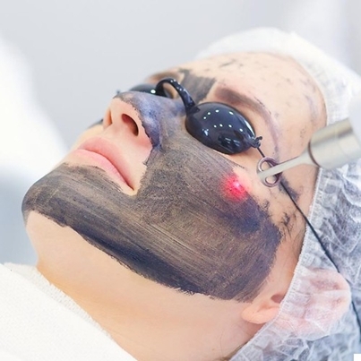 Ošetření Hollywood Carbon Peel